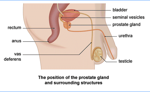 treatment of prostate cancer in homeopathy