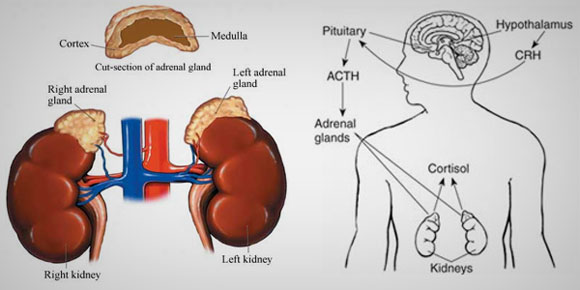 What Causes Addison Disease