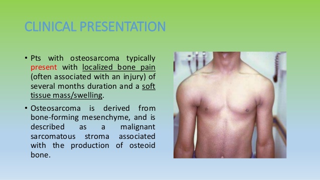 causes of osteosarcoma