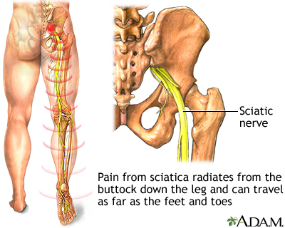 sciatic nerve location image