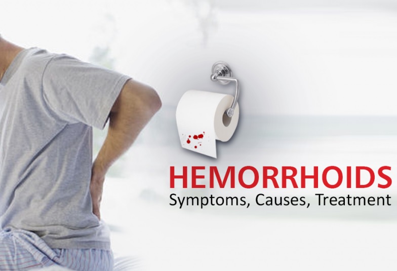 Hemorrhoids symptoms causes and homeopathic treatment
