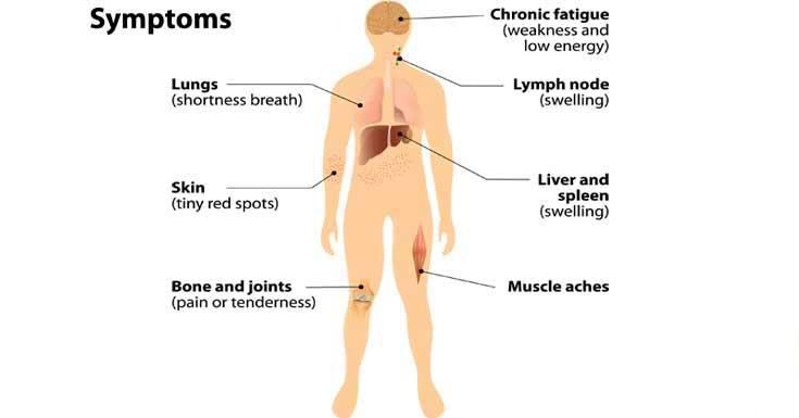 What is Lymphoma Symptoms and Homeopathic Treatment