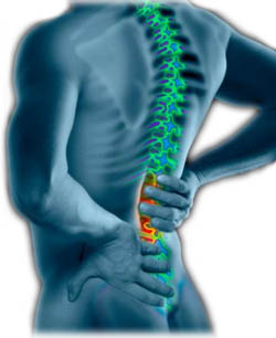 Homeopathic treatment of lumbar pain image