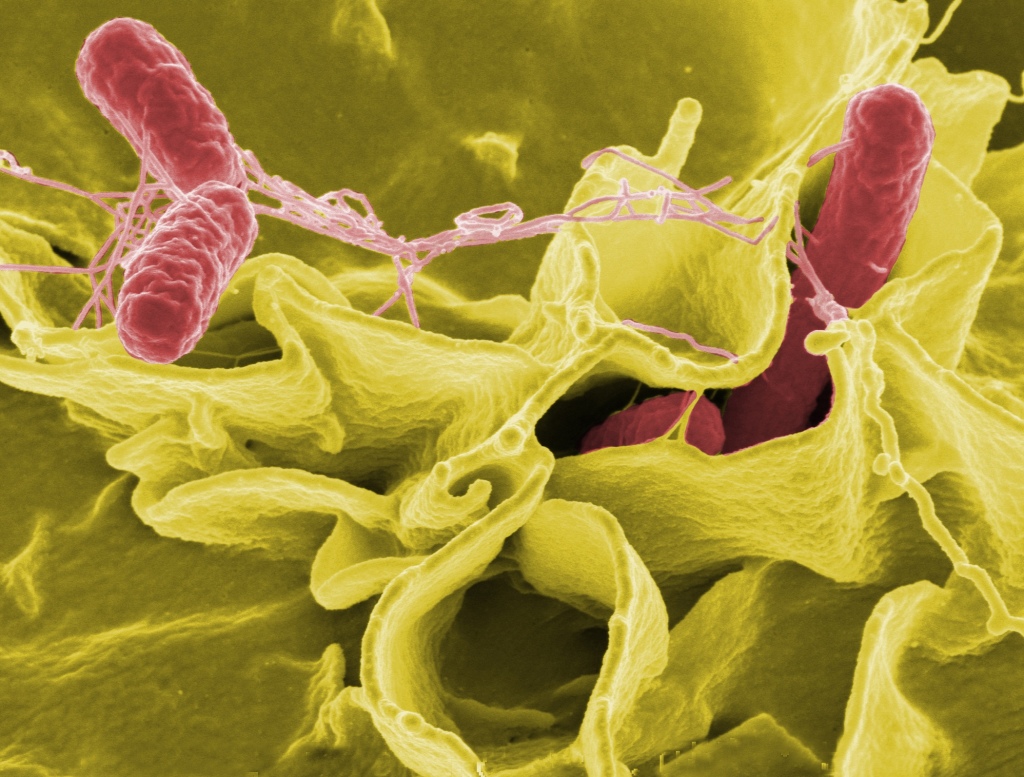 Typhoid Fever Definition Permanent Safe Cure In Homeopathy