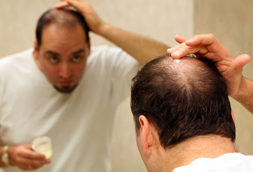 Hair Falling Symptoms, Causes and Cure in Homeopathy -