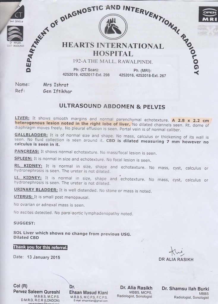 Medical Report Showing Liver Cancer of Mrs. Ishrate