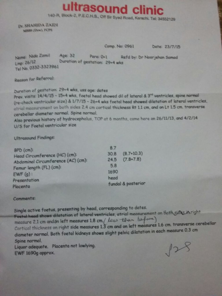 Medical Report Showing Improvement in Hydrocephalus Baby