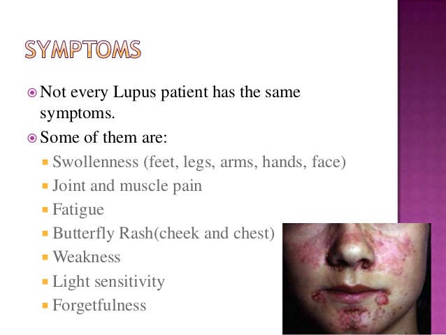 what is lupus butterfly rash