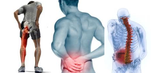 what is sciatica pain