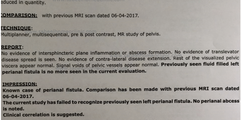 anal_fistual_case_study_homeopathic_treatment