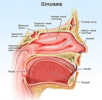 Sinusitis Possible Causes Symptoms