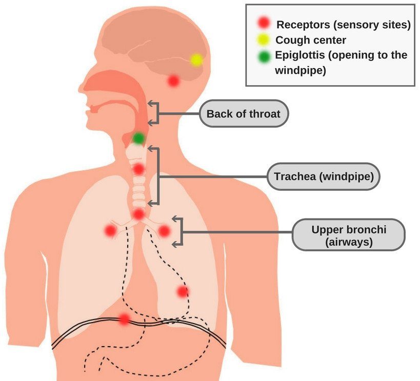 Acute and Chronic Cough Symptoms Causes treatment