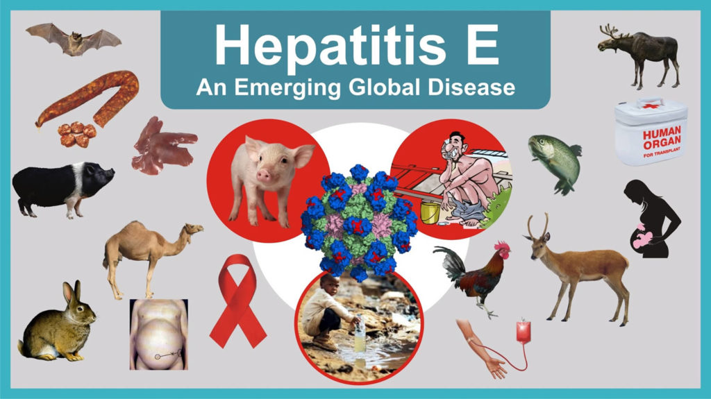Hepatitis E-Symptoms-Causes-Treatment Homeopathic Treatment