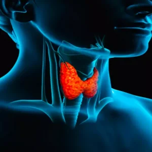 Thyroid disease Patient cured by homeopathic medicine