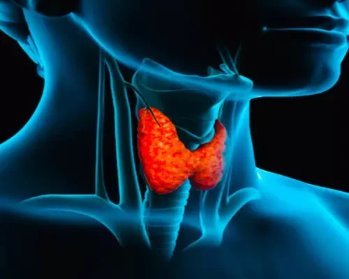 Thyroid Disease cured by homeo Dr. Sabeel